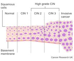 CIN 1, CIN 2, CIN 3 Nedir?