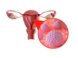 Yüksek Riskli HPV Tarama