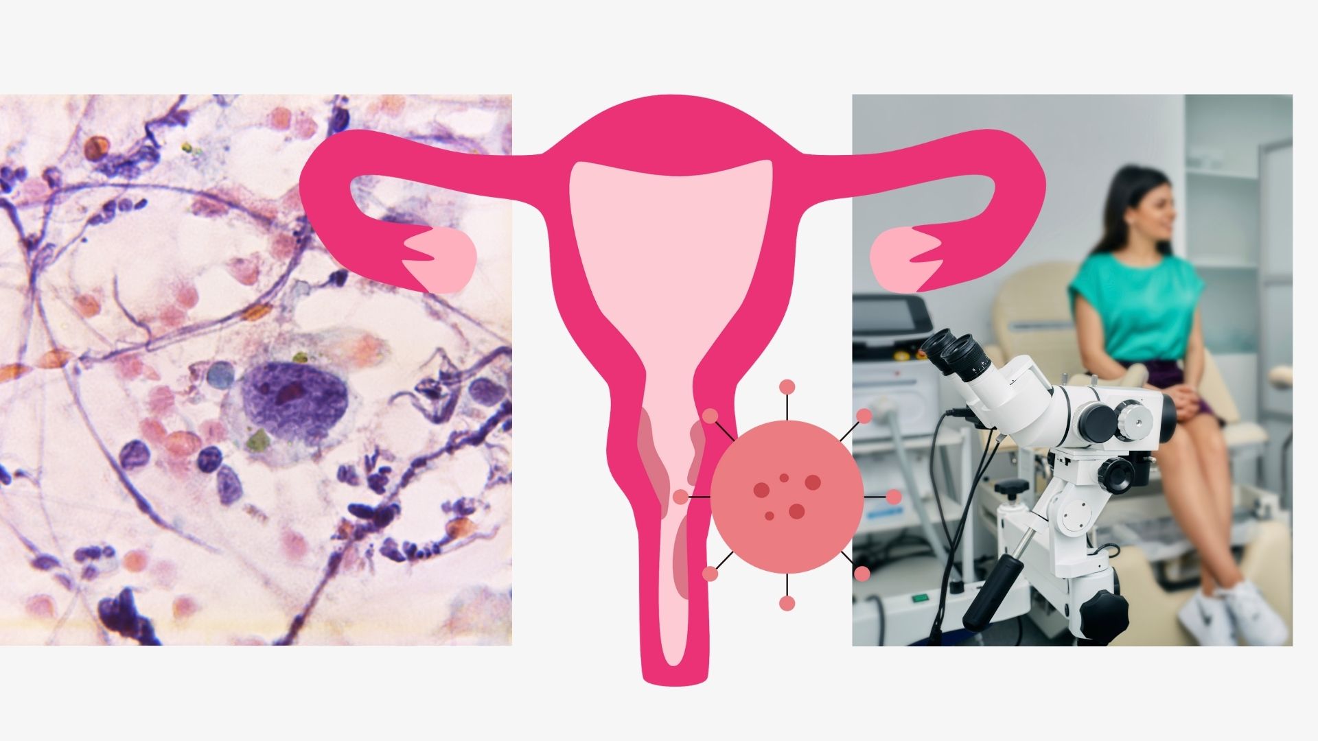 Kolposkopi Hakkında Sık Sorulan Sorular ve Cevaplar